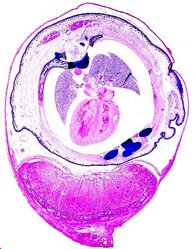 Cross section of uterus with 20 day fetal chest inside the membranes; placental disk below.
