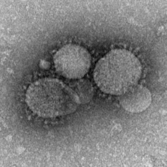 Nuevas partículas de coronavirus como se ve por microscopía electrónica de tinción negativa.  Los viriones contienen proyecciones características tipo club que emanan de la membrana viral.