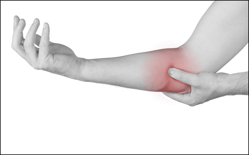 Golfer's Elbow (also known medial epicondylitis) | Complete Physio