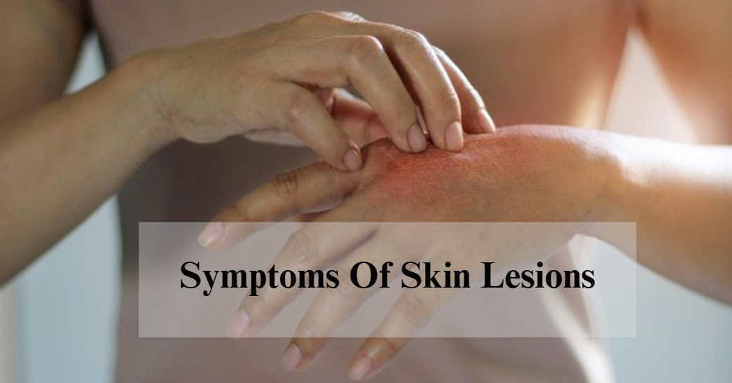What Are The Symptoms Of Skin Lesions?