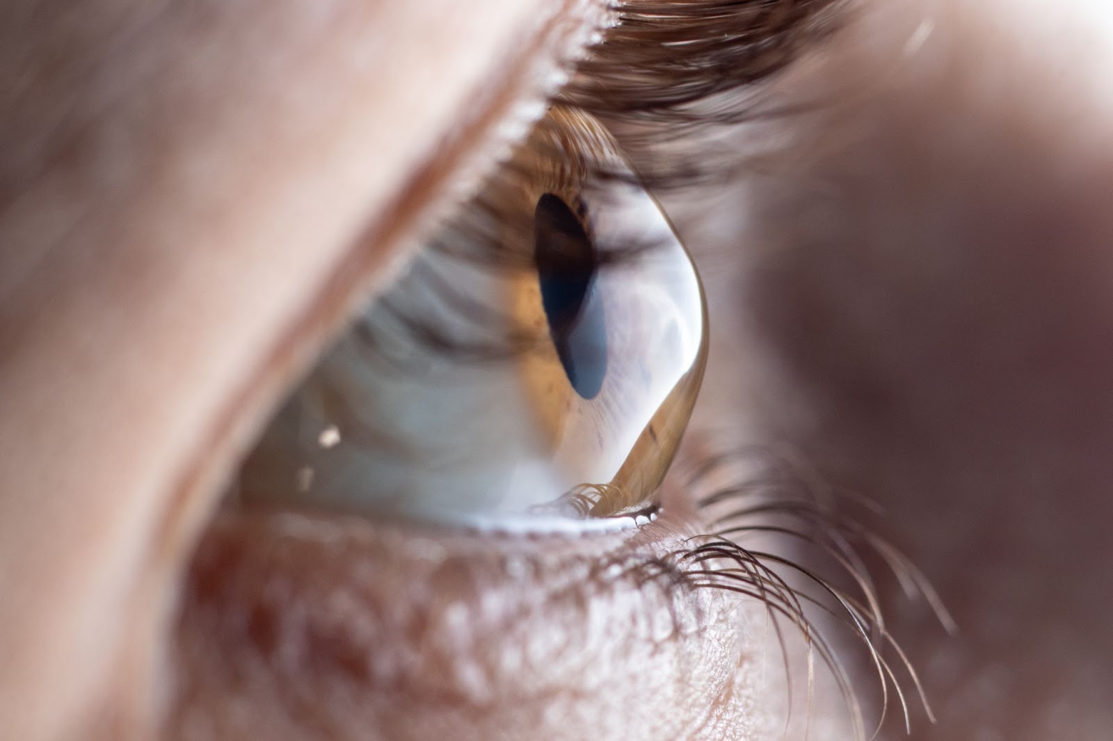 Ce este astigmatismul și cum îl putem corecta? - Blog de optică medicală |  Lensa.ro