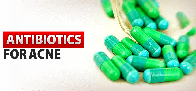 ANTIBIOTICS-FOR-ACNE