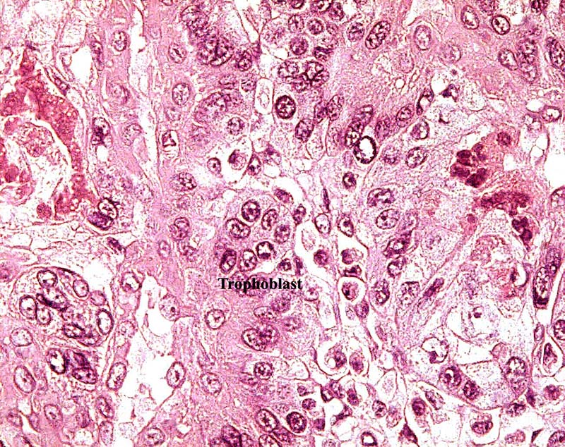 Interface of endothelio-chorial placenta with the trophoblast labeled.
