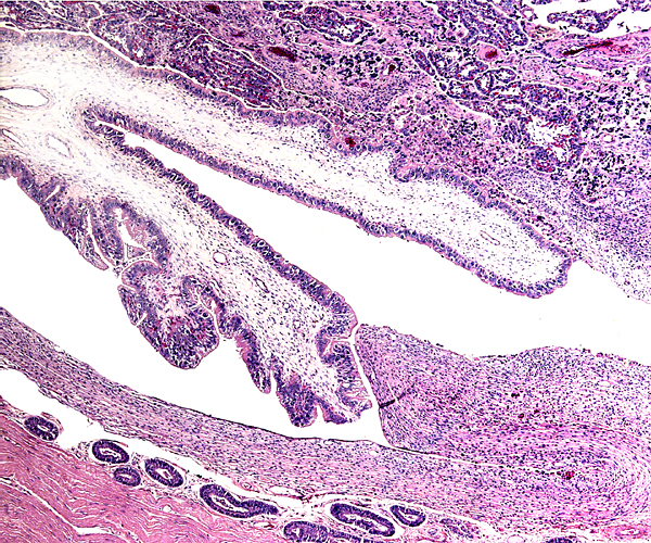 Edge of placenta with columnar trophoblast of allantochorion