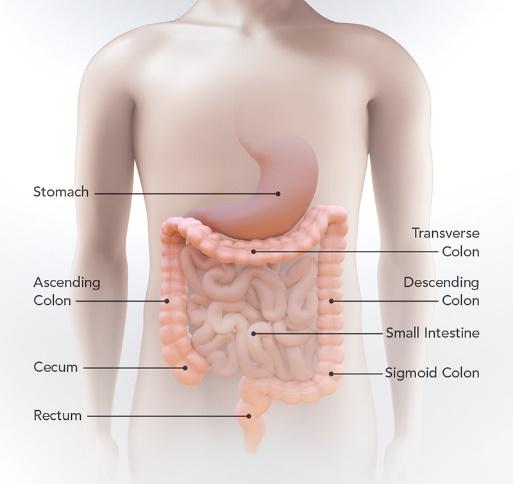 What Is Colorectal Cancer? | CDC