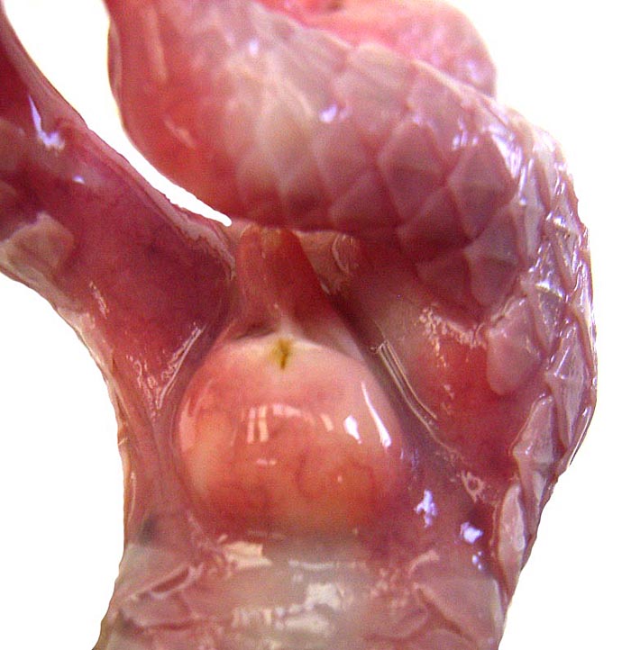 External genitalia of the first male fetus with descended testes.