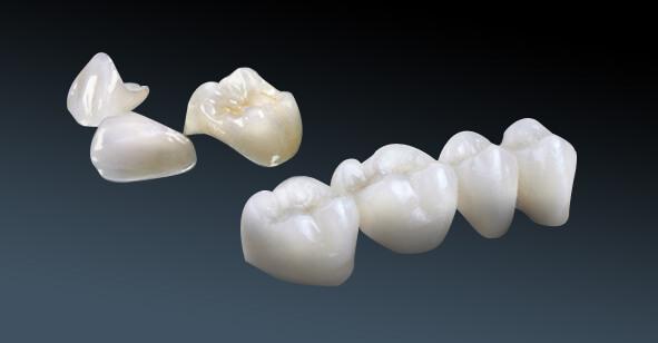 C:\Users\Phuong Tran\Desktop\7.10 răng sứ zirconia và cercon\Rang-su-zirconia-va-cercon-2.jpg