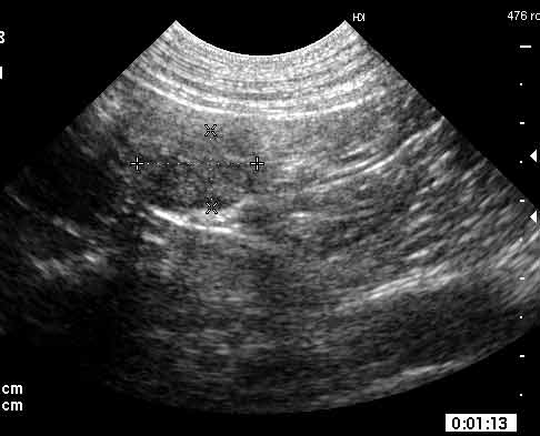 Mid-gestation luteal phase ovary