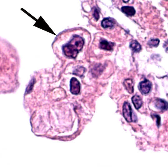 Binucleated trophoblastic cell