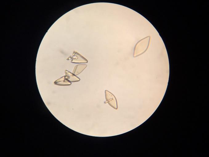 Examen complet de urina (sumar si sediment) | Laboratoarele Sfanta Maria