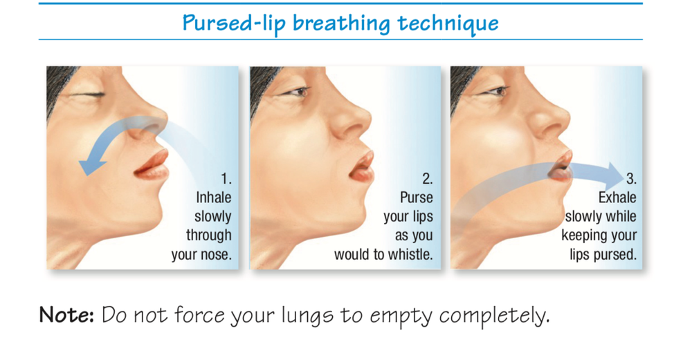 2. Teknik Pernapasan Pursed-Lips Breathing