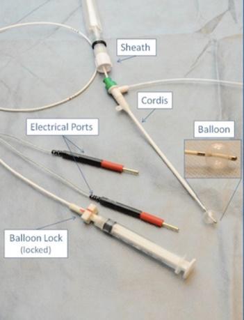 Transvenous Pacemaker