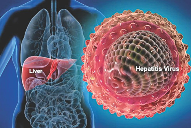 Hepatitis-A.jpg