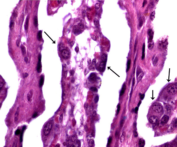 Higher magnification of binucleate cells at arrows.