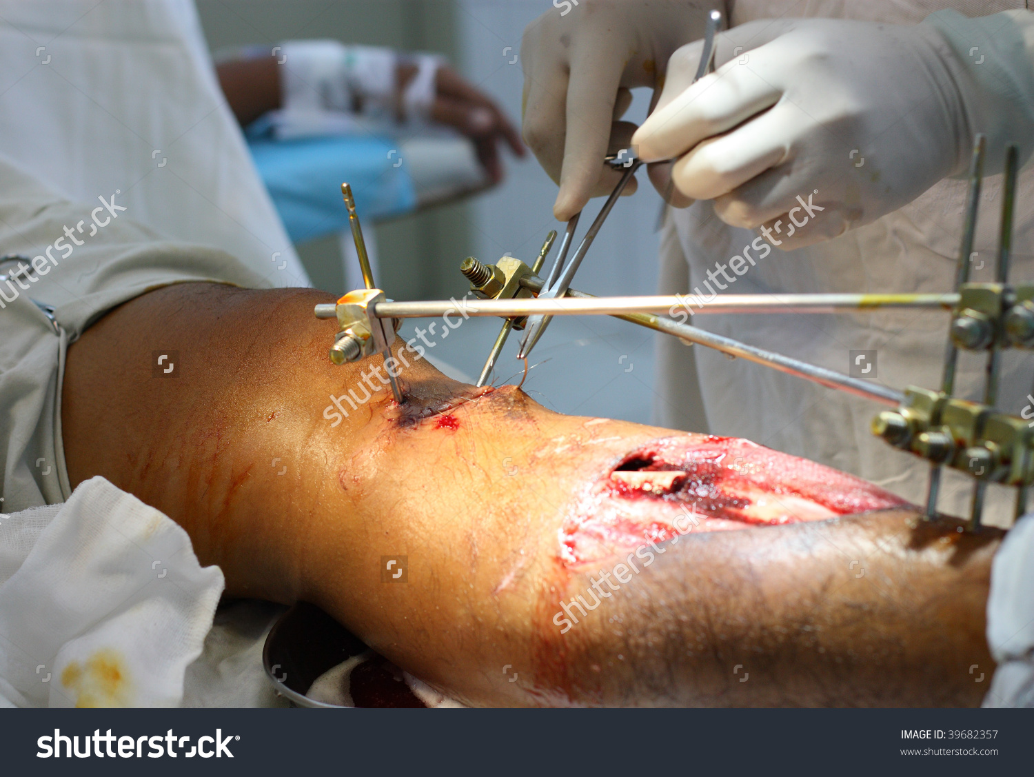 Image result for orthopedic surgeon