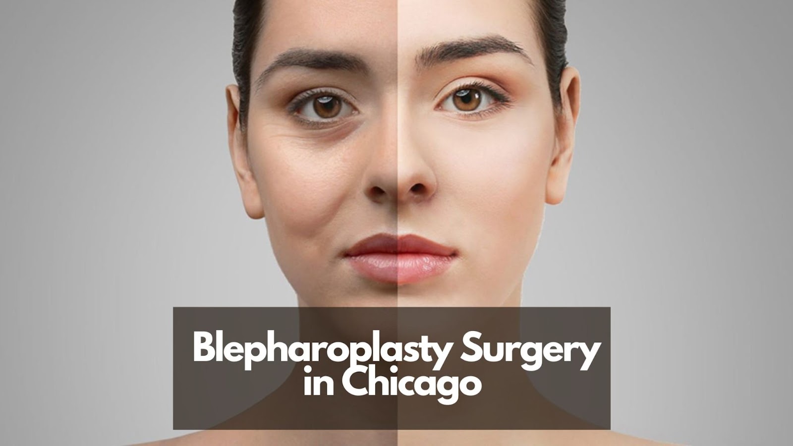 Chicago Blepharoplasty Surgery at SDMD - Steven Dayan, MD. 