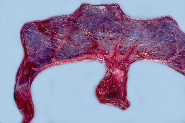 Fetal surface of Southern white rhinoceros placenta