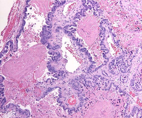 Fetal-maternal barrier of labyrinthine tiger placenta