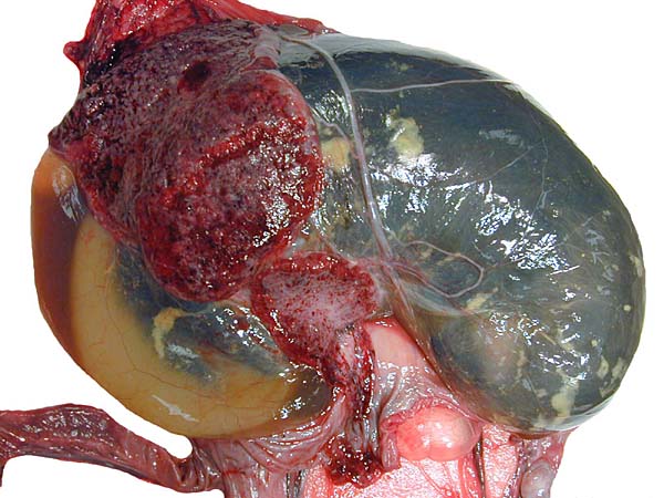 Partially opened uterus with amnion and allantoic fluid-filled sacs visible at left and ring-shaped placenta extending over the fetus that is still contained in the uterus