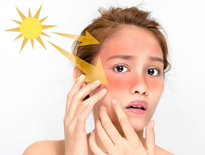 Tia UV (tia cực tím) là một trong những nguyên nhân làm xuất hiện các vết nám
