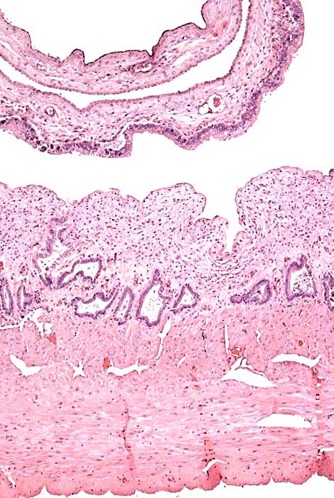 Implantation site between cotyledons with myometrium below.