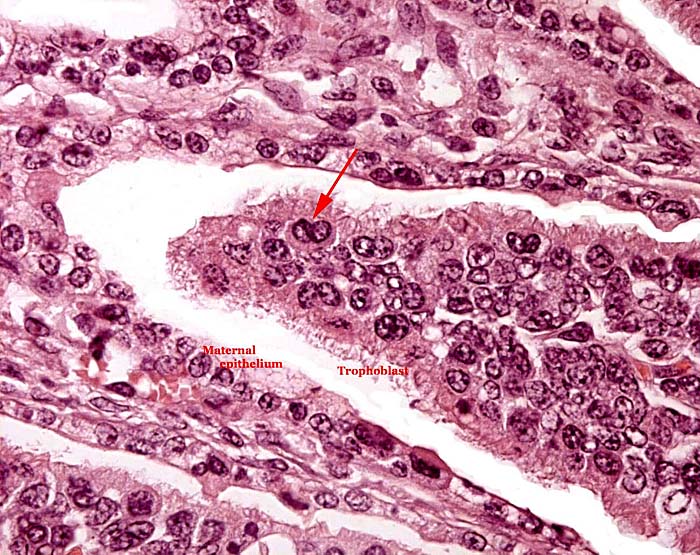 Villus (inside) with binucleate cell at arrow.