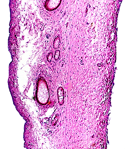 Section through the allanto-amnion. The vascularized allantoic sac membrane is at the left, the amnion at right. The epithelium has largely degenerated post mortem