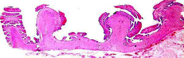 Endometrium of neonatal pygmy hippopotamus