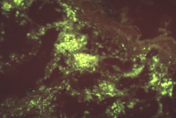CPV viral antigen primarily in crypt areas of small intestinal (ilium) epithelium (Immunofluorescence microscopy).