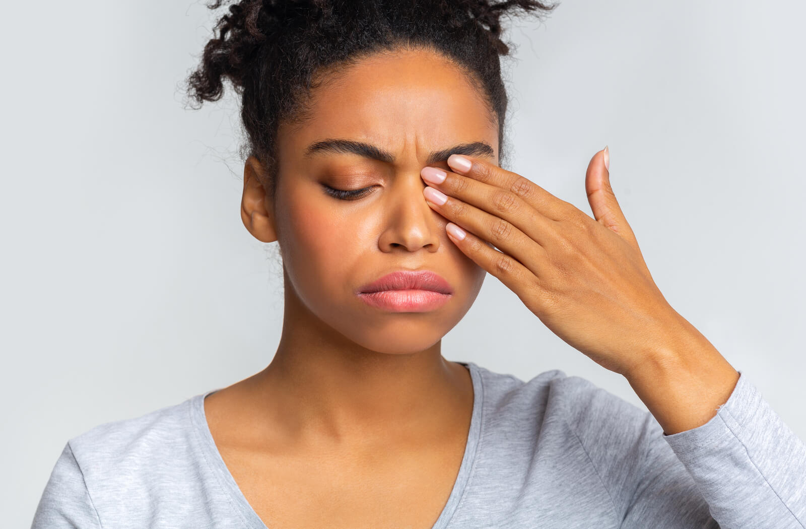 A woman rubbing her left eye due to dry eye