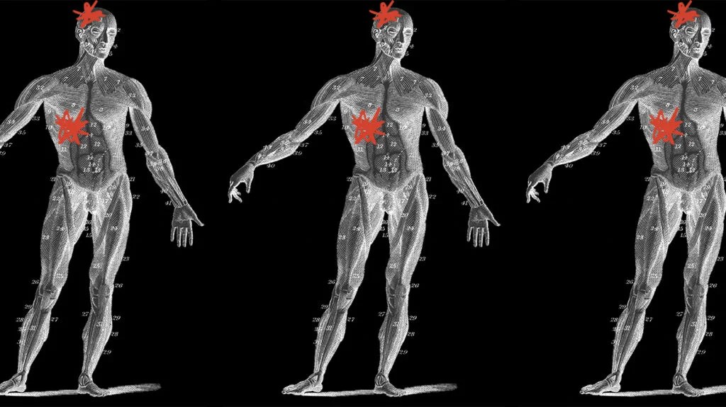 triplicate illustration of the human body emphasizing the location of the brain and the liver with red asterisks