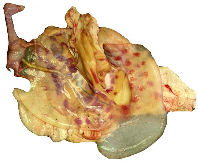 Opened uterus with fetus in left horn