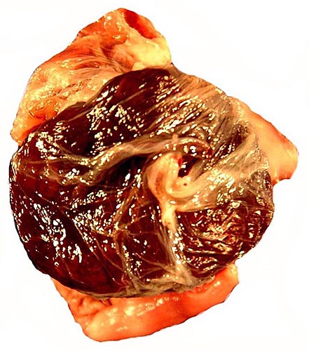 Placental disk attached to uterus
