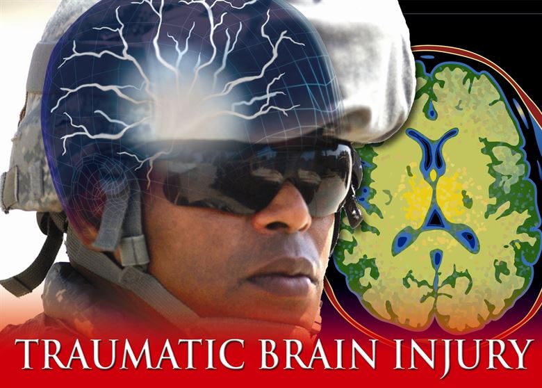 Brain Injuries potentially have long-term consequences