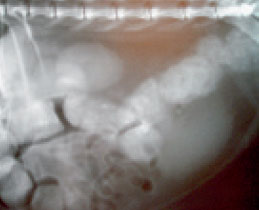 Megacolon in a cat who previously suffered from pelvic fractures