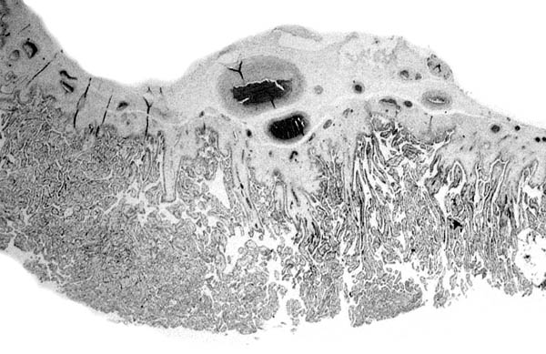 Cross-section of cotyledonary surface