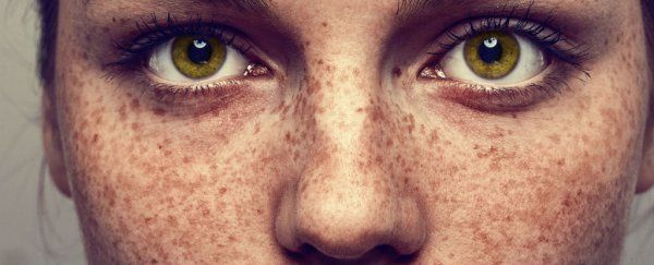Skin/Blemishes: Freckles