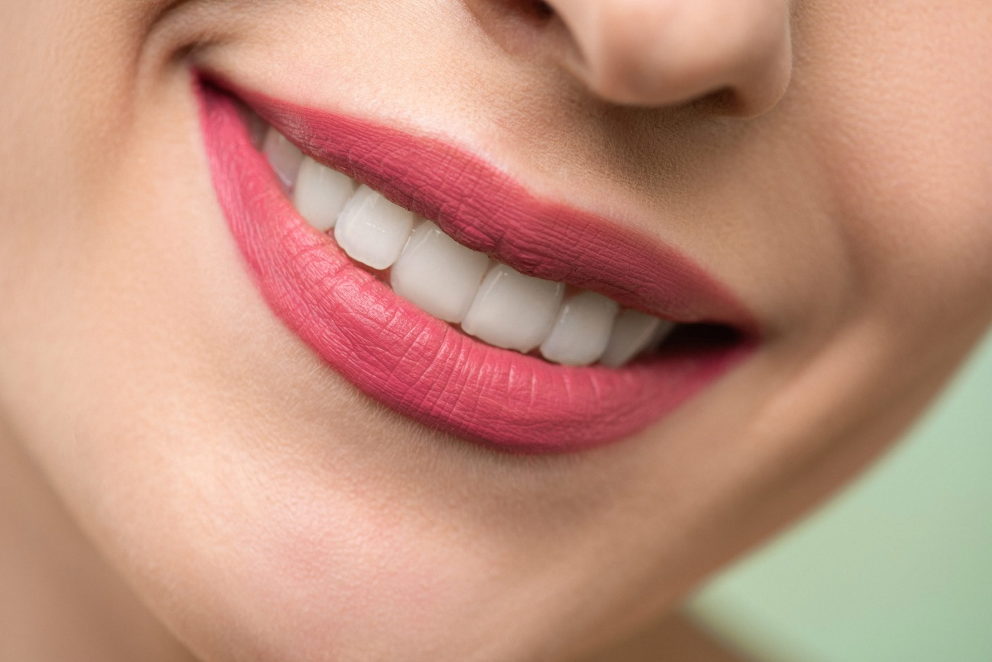 teeth whitening in Vancouver