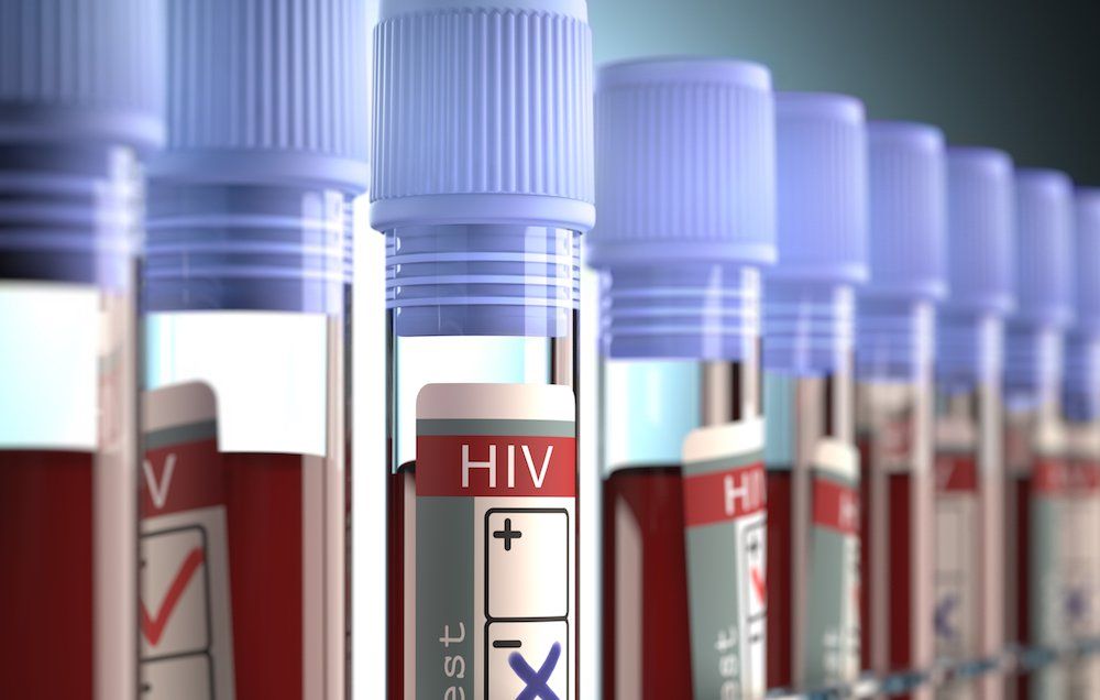 hiv test malaysia