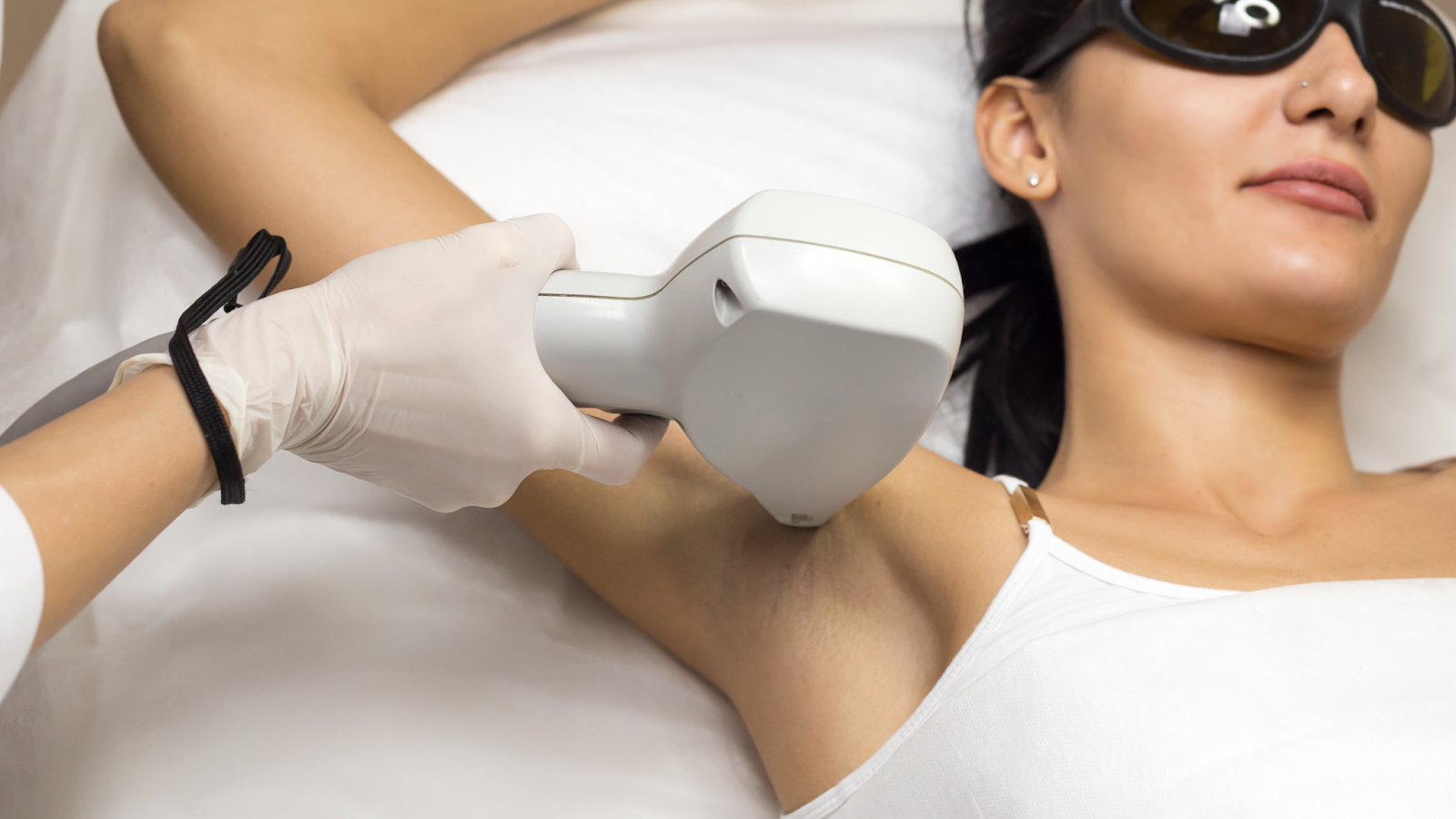 Can laser hair removal stimulate hair growth?