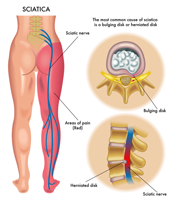 vật lý trị liệu