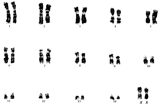 Karyotype of female aye-aye, 2n=30
