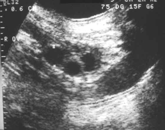 The right ovary of a Beagle bitch examined at 1 day after the LH surge