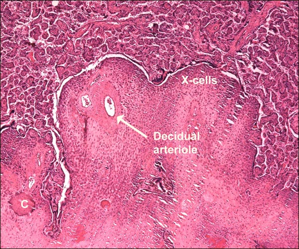 Implantation site of mature rhesus monkey placenta. There is a large profusion of extravillous trophoblast and fibrinoid in the sparse decidua basalis