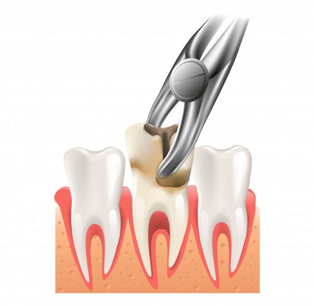 Realistic illustration dental surgery in 3d vector Premium Vector