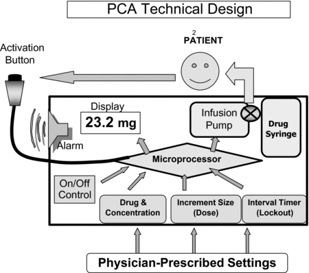 Patient-Controlled Analgesia Devices and Analgesic Infusion Pumps (Chapter  19) - Acute Pain Management