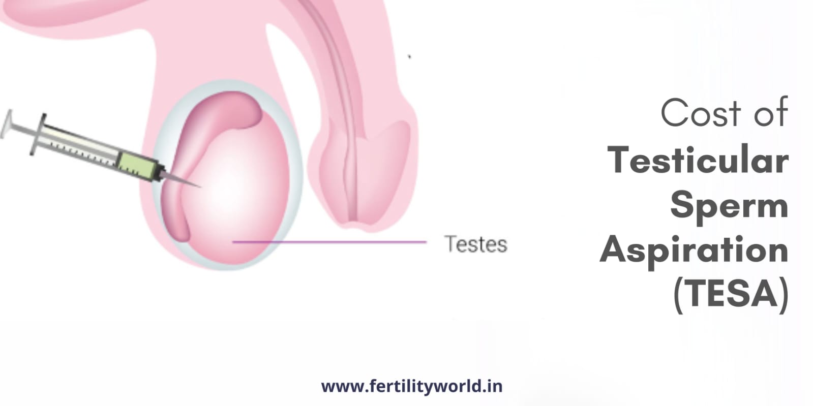 Cost of Testicular Sperm Aspiration (TESA) in India