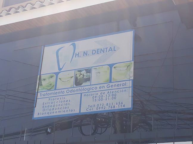 Opiniones de H.N. Dental en Cuenca - Dentista