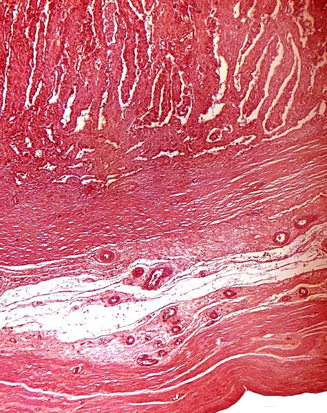 Implanted eland placenta near term. Myometrium below