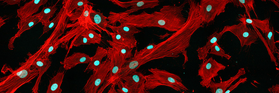 Mesenchymal Stem Cells Debates and Updates
